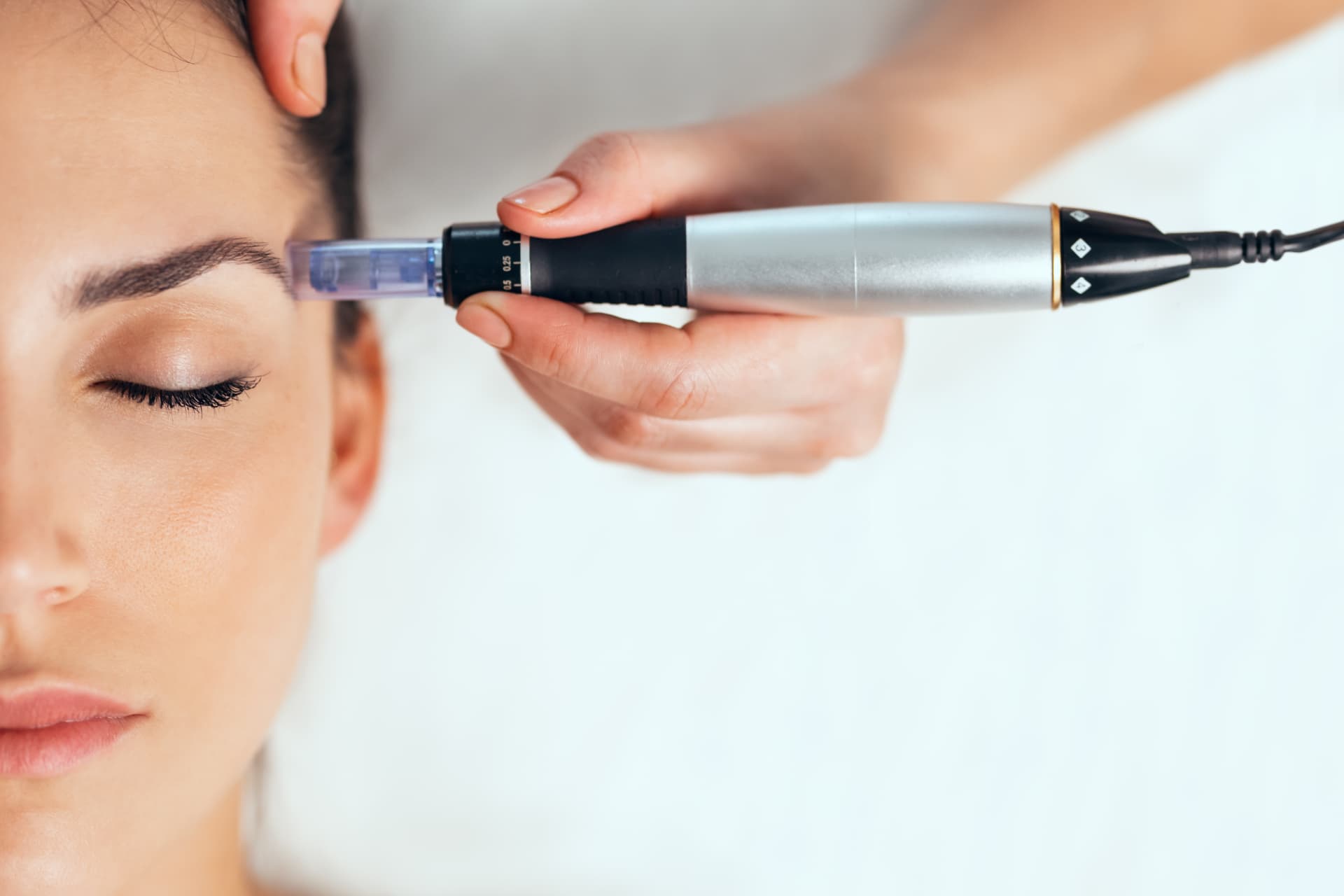Microneedling-Pen an der Stirnpartie